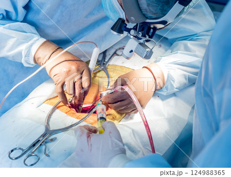 Spinal surgery. Group of surgeons in operating room with surgery equipment.  124988365