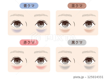 目の下のクマ4タイプ比較|美容・スキンケア解説用イラスト 目の下のクマ4タイプ比較|美容・スキンケア解説用イラスト 125014331