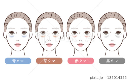 目の下のクマ4タイプ比較｜美容・スキンケア解説用イラスト 125014333