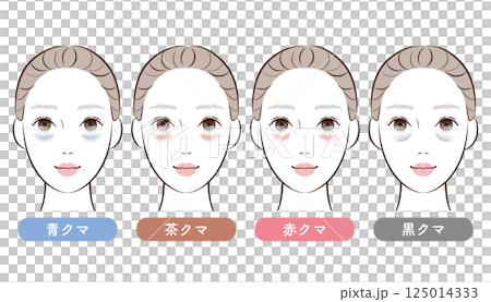 目の下のクマ4タイプ比較｜美容・スキンケア解説用イラスト 125014333
