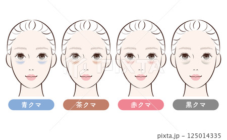 目の下のクマ4タイプ比較|美容・スキンケア解説用イラスト 目の下のクマ4タイプ比較|美容・スキンケア解説用イラスト 125014335