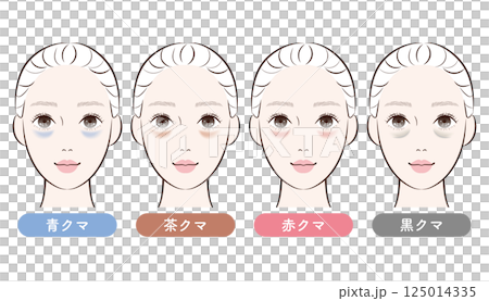 目の下のクマ4タイプ比較|美容・スキンケア解説用イラスト 目の下のクマ4タイプ比較|美容・スキンケア解説用イラスト 125014335
