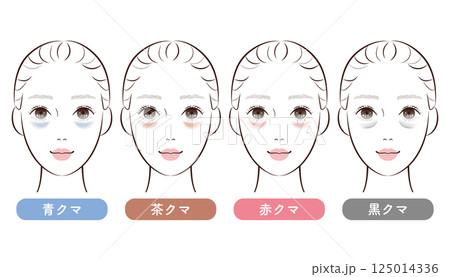 目の下のクマ4タイプ比較|美容・スキンケア解説用イラスト 目の下のクマ4タイプ比較|美容・スキンケア解説用イラスト 125014336