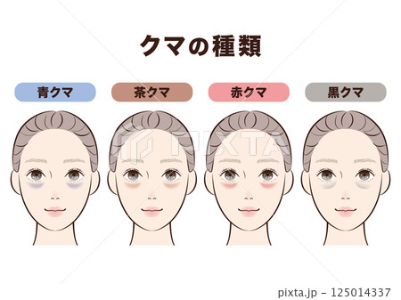 目の下のクマ4タイプ比較|美容・スキンケア解説用イラスト 目の下のクマ4タイプ比較|美容・スキンケア解説用イラスト 125014337