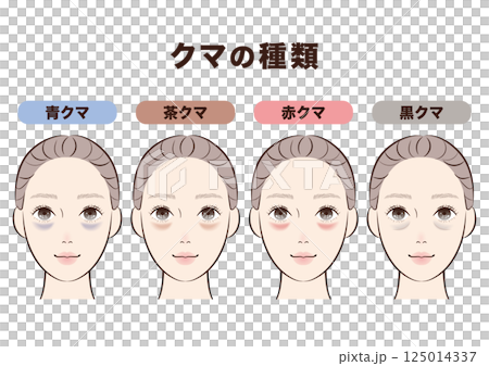 目の下のクマ4タイプ比較|美容・スキンケア解説用イラスト 目の下のクマ4タイプ比較|美容・スキンケア解説用イラスト 125014337