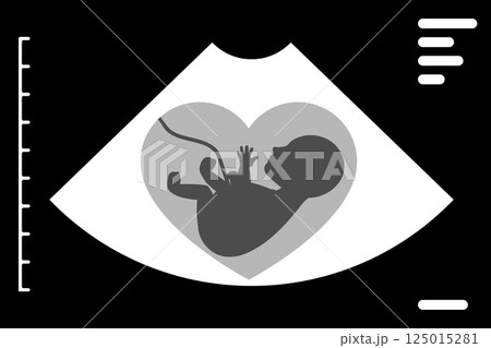 Ultrasound scan showing baby silhouette inside heart shape 125015281