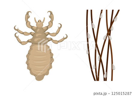 Head louse and nits clinging to hair strands causing pediculosis Head louse and nits clinging to hair strands causing pediculosis 125015287