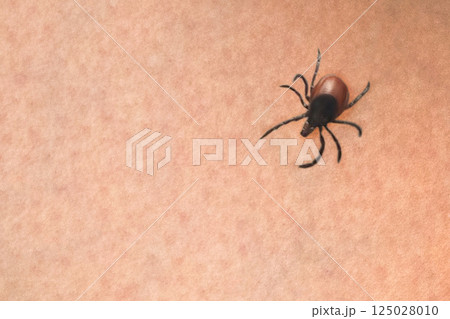 Tick on the skin, close up Tick on the skin, close up 125028010