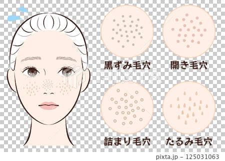 鼻毛孔困擾4種套裝 |皮膚鬆弛、阻塞、黑頭、毛孔粗大的插圖素材 125031063