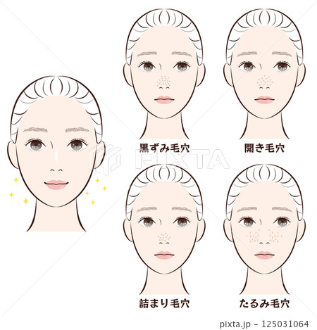 鼻の毛穴トラブル4種類セット|たるみ・詰まり・黒ずみ・開き毛穴のイラスト素材 鼻の毛穴トラブル4種類セット|たるみ・詰まり・黒ずみ・開き毛穴のイラスト素材 125031064