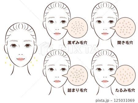 鼻の毛穴トラブル4種類セット｜たるみ・詰まり・黒ずみ・開き毛穴のイラスト素材 125031069
