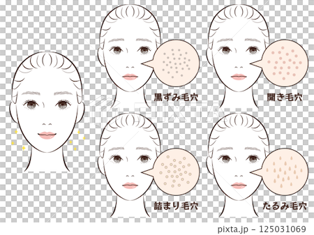 鼻の毛穴トラブル4種類セット｜たるみ・詰まり・黒ずみ・開き毛穴のイラスト素材 125031069