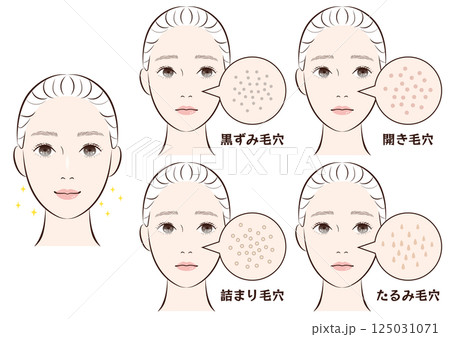 鼻の毛穴トラブル4種類セット|たるみ・詰まり・黒ずみ・開き毛穴のイラスト素材 鼻の毛穴トラブル4種類セット|たるみ・詰まり・黒ずみ・開き毛穴のイラスト素材 125031071