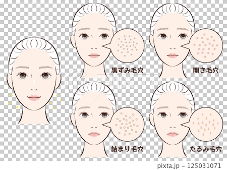 鼻の毛穴トラブル4種類セット|たるみ・詰まり・黒ずみ・開き毛穴のイラスト素材 鼻の毛穴トラブル4種類セット|たるみ・詰まり・黒ずみ・開き毛穴のイラスト素材 125031071