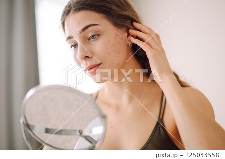 Woman worry about her face when she saw the problem of acne occur by a mini mirror. Pimples, acne Woman worry about her face when she saw the problem of acne occur by a mini mirror. Pimples, acne 125033558