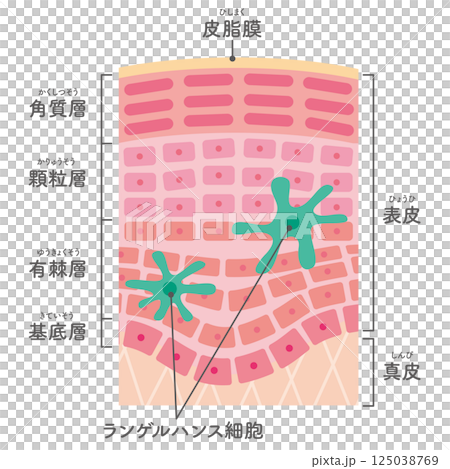 炎症した肌の断面のイラスト/ランゲルハンス細胞の追加(名称あり) 炎症した肌の断面のイラスト/ランゲルハンス細胞の追加(名称あり) 125038769