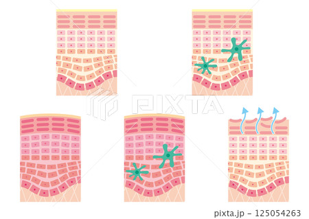 肌の断面図セット(名称なし) 肌の断面図セット(名称なし) 125054263