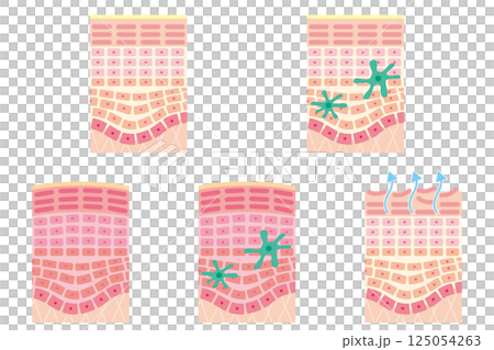 肌の断面図セット(名称なし) 肌の断面図セット(名称なし) 125054263
