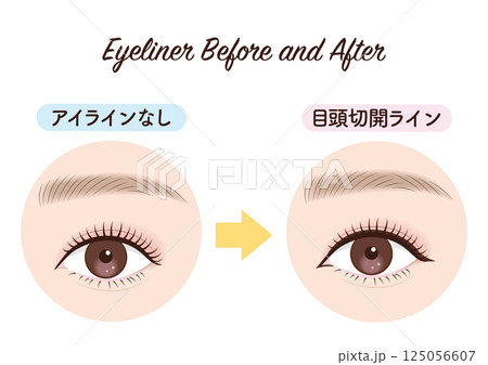 アイライン ビフォーアフター 目頭切開ライン アイライン ビフォーアフター 目頭切開ライン 125056607