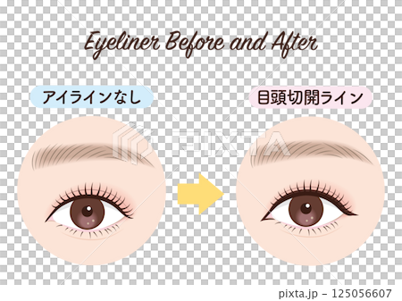 Eyeliner before and after eye incision line Eyeliner before and after eye incision line 125056607