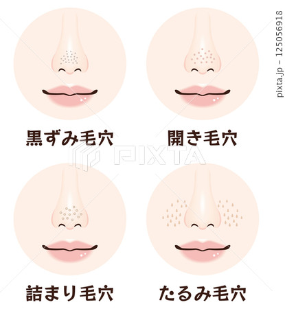 鼻の毛穴トラブル4種類セット|黒ずみ・開き・詰まり・たるみ毛穴の鼻アップ素材 鼻の毛穴トラブル4種類セット|黒ずみ・開き・詰まり・たるみ毛穴の鼻アップ素材 125056918