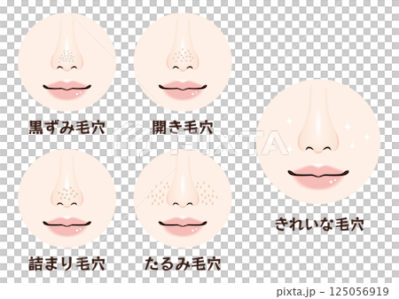 鼻の毛穴トラブル4種類セット|黒ずみ・開き・詰まり・たるみ毛穴の鼻アップ素材 鼻の毛穴トラブル4種類セット|黒ずみ・開き・詰まり・たるみ毛穴の鼻アップ素材 125056919