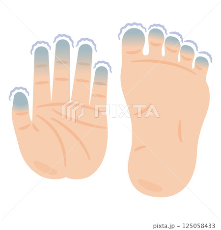 指先が冷えた足と手のイラスト 125058433