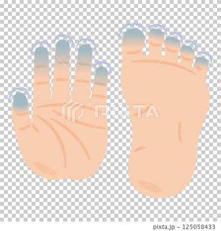Illustration of cold feet and hands 125058433