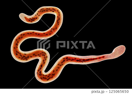 Brugia malayi, a roundworm nematode 125065650