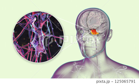 Neurons, brain cells, located in the pons Varolii of the human brain Neurons, brain cells, located in the pons Varolii of the human brain 125065791
