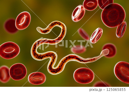 Brugia malayi, a roundworm nematode Brugia malayi, a roundworm nematode 125065855