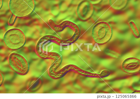 Brugia malayi in blood, a roundworm nematode 125065866