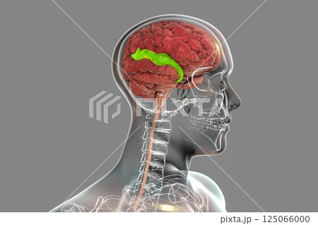Human brain in body with highlighted superior temporal gyrus Human brain in body with highlighted superior temporal gyrus 125066000