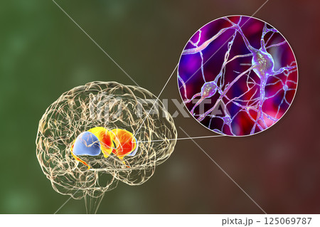 Dorsal striatum in the brain and closeup view of its neurons, 3D illustration Dorsal striatum in the brain and closeup view of its neurons, 3D illustration 125069787