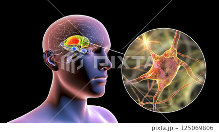 Dorsal striatum in the brain and closeup view of its neurons Dorsal striatum in the brain and closeup view of its neurons 125069806