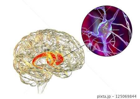 Caudate nuclei highlighted in human brain and closeup view of its neurons 125069844