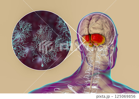Human brain with highlighted cerebellum and close-up view of Purkinje neurons 125069856