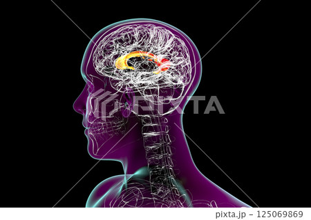 Human brain with highlighted Corpus callosum, also known as callosal commissure Human brain with highlighted Corpus callosum, also known as callosal commissure 125069869