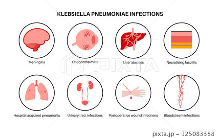 Klebsiella pneumoniae poster 125083388