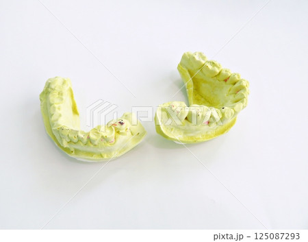 Dental Oral Stone Model 125087293