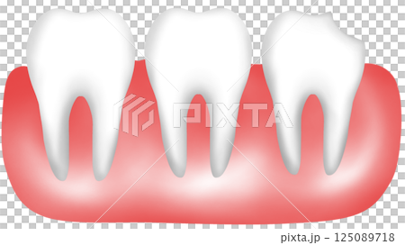 Human tooth anatomy with chipped and broken features 125089718