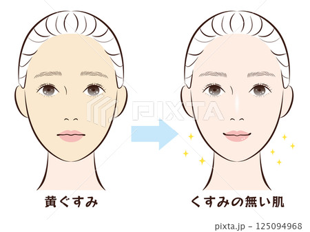 黄ぐすみ肌からくすみの無い肌へのビフォーアフター 黄ぐすみ肌からくすみの無い肌へのビフォーアフター 125094968