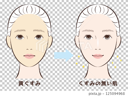 黄ぐすみ肌からくすみの無い肌へのビフォーアフター 黄ぐすみ肌からくすみの無い肌へのビフォーアフター 125094968