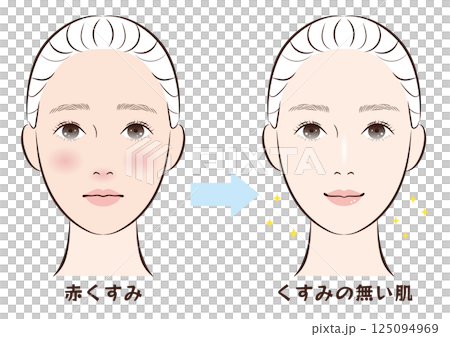 Before and after from red dull skin to clear skin Before and after from red dull skin to clear skin 125094969