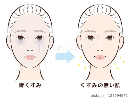 青くすみ肌からくすみの無い肌へのビフォーアフター 青くすみ肌からくすみの無い肌へのビフォーアフター 125094971