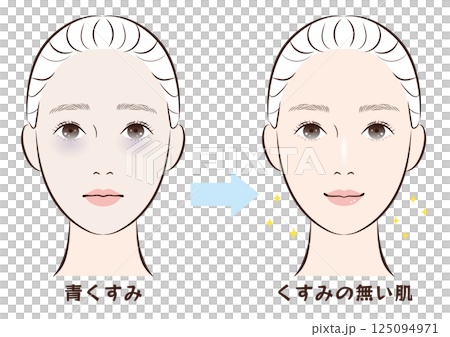 青くすみ肌からくすみの無い肌へのビフォーアフター 青くすみ肌からくすみの無い肌へのビフォーアフター 125094971