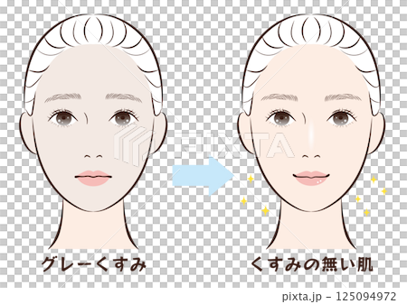 Before and after from grey dull skin to clear skin 125094972