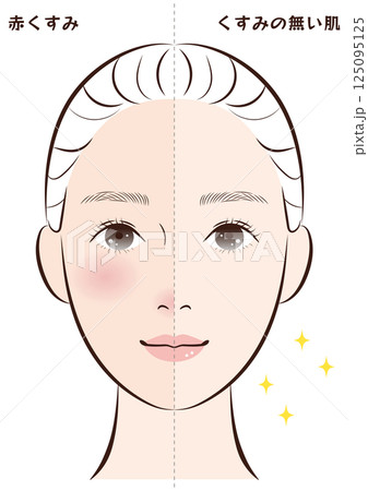 赤くすみ肌からくすみの無い肌へのビフォーアフター 125095125
