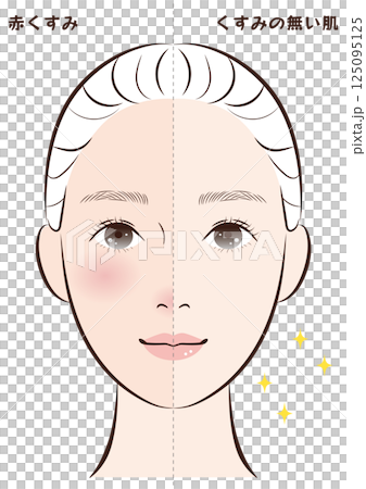 赤くすみ肌からくすみの無い肌へのビフォーアフター 125095125