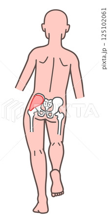 トレンデレンブルグ徴候の人体 125102061